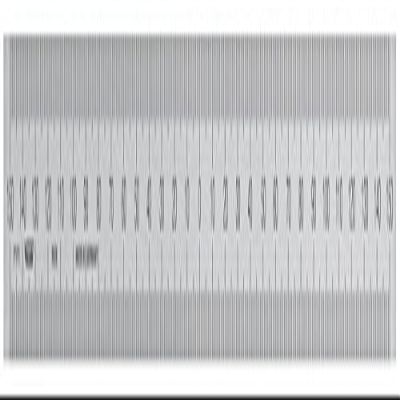 Vogel Germany Steel Ruler, 0–100 mm, 18 mm × 0.5 mm