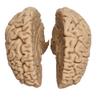 Human Brain, Natural Specimen Cast view 1
