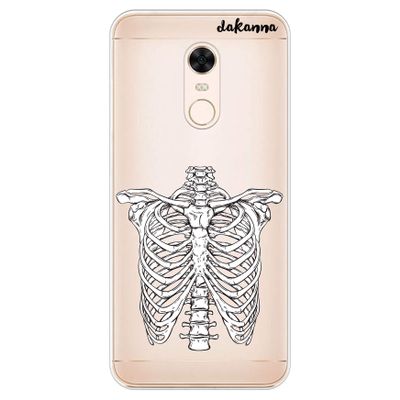 dakanna Clear Flexible TPU Case for Xiaomi Redmi 5 Plus/Note 5, Skeleton Halloween Bones Design