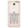 dakanna Clear Flexible TPU Case for Xiaomi Redmi 5 Plus/Note 5, Skeleton Halloween Bones Design view 1