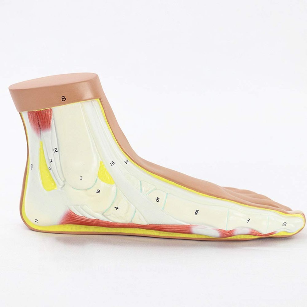 LBYLYH Educational Flatfoot Arch Collapse Anatomy Model