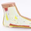 LBYLYH Educational Flatfoot Arch Collapse Anatomy Model view 4