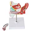 LBYLYH Human Male Genitourinary System Model with Benign Prostatic Hyperplasia view 3