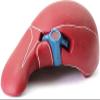 LBYLYH Human Liver Anatomical Teaching Model view 3