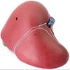 LBYLYH Human Liver Anatomical Teaching Model view 4