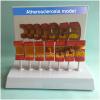 DYTAH Human Artery Anatomy Model with Atherosclerosis and Thrombus view 2