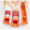 VIDECOR Arteriovenous Model of Human Blood Vessel Anatomy view 4