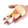 WlP Dental Caries Model, Comprehensive Dental Pathology Model for School Study view 2
