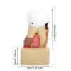 WlP Dental Caries Model, Comprehensive Dental Pathology Model for School Study view 3