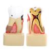 WlP Dental Caries Model, Comprehensive Dental Pathology Model for School Study view 4