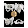 Educational Anatomical Model of the Female Pelvis view 3