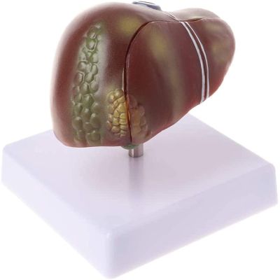 Pathological Anatomical Model of the Human Liver