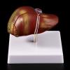 Pathological Anatomical Model of the Human Liver view 3