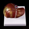 Pathological Anatomical Model of the Human Liver view 4