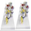 Human Anatomy Model, Skeletal Pathology and Lumbar Disc Model, 1:1 Scale view 1