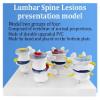 Human Anatomy Model, Skeletal Pathology and Lumbar Disc Model, 1:1 Scale view 3