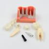 Implant Analysis Bridge, Removable Demonstration Dental Model for Dentist-Patient Communication, Patient Education, Students, and Teaching/Research view 2