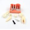 Implant Analysis Bridge, Removable Demonstration Dental Model for Dentist-Patient Communication, Patient Education, Students, and Teaching/Research view 3