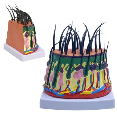 Hair Growth Cycle Model with Enlarged Scalp Follicles