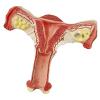 VDLLQYN Human Female Uterus and Ovary Anatomical Cross-Section Model view 3