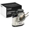 RIDEX 158T0365 Throttle Body Compatible with HYUNDAI SANTA F II (CM), 351003E100 view 1