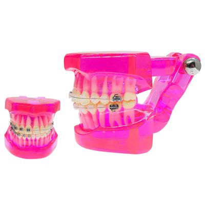 HADECOLL Dental Model – Removable Dental Implant Restoration Model, Semi-Metallic and Semi-Ceramic, Pink, 6 cm