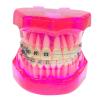 HADECOLL Dental Model – Removable Dental Implant Restoration Model, Semi-Metallic and Semi-Ceramic, Pink, 6 cm view 3