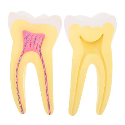 Garneck Compact Molar Model, Simulated PVC Tooth Specimen