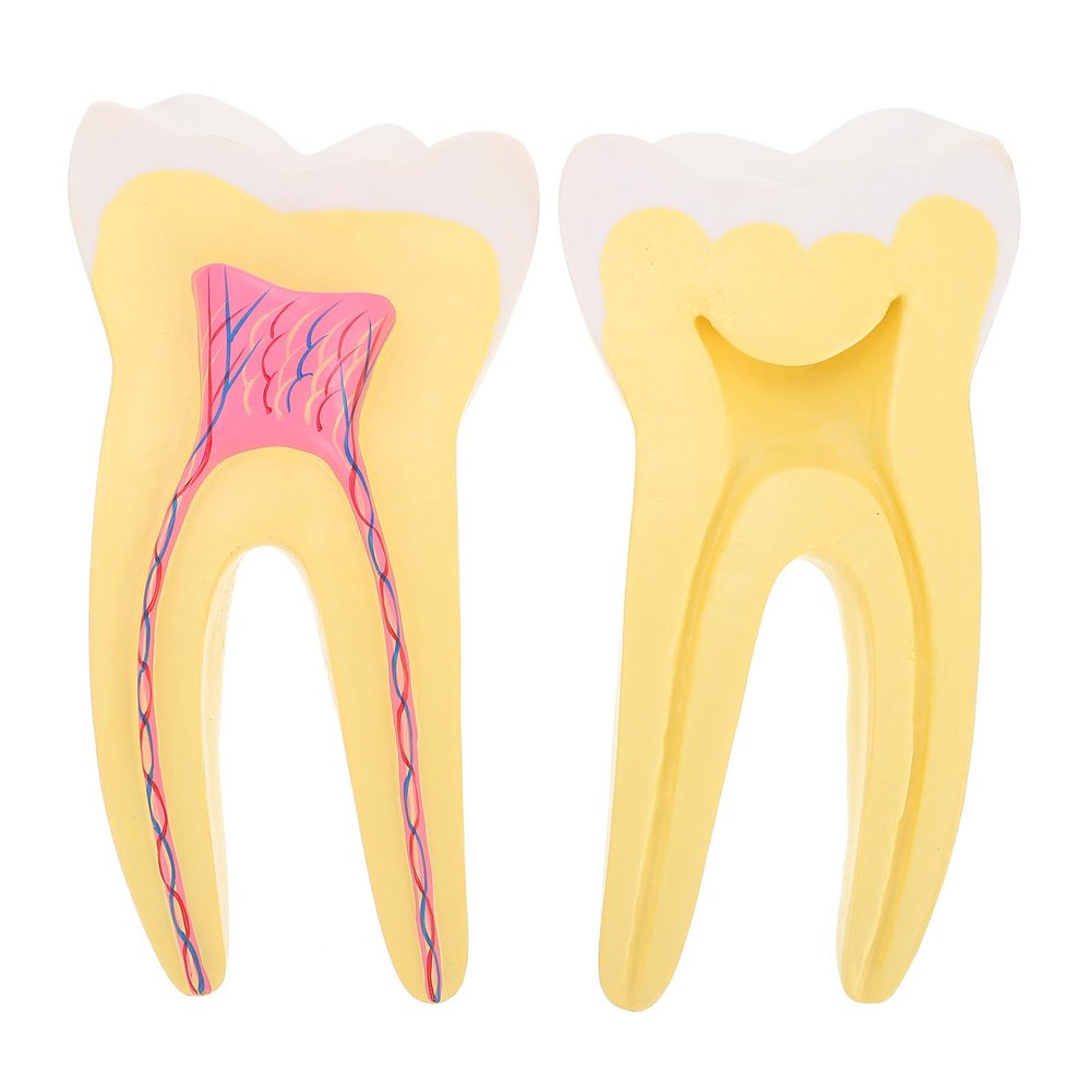 Garneck Compact Molar Model, Simulated PVC Tooth Specimen