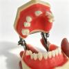 Dental Implant Training Model: Jaw, Maxillary Sinus, and Mandibular Bridge Models view 3