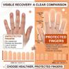 GXGM 20 Pack Waterproof Finger Protectors view 4