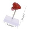 LOPUNER Lifelike Portable Lightweight Plastic Human Bladder Model for Biology Classes view 2