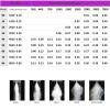 50 Brass Fine-Mist Nozzles, 0.30 mm Three-Section Extended Aperture, 3010 view 4